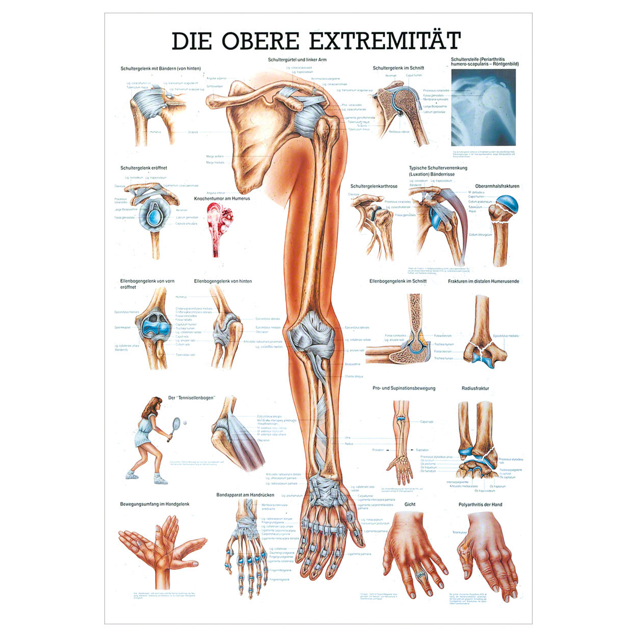 Anatomische Lehrtafel - Die obere Extremität