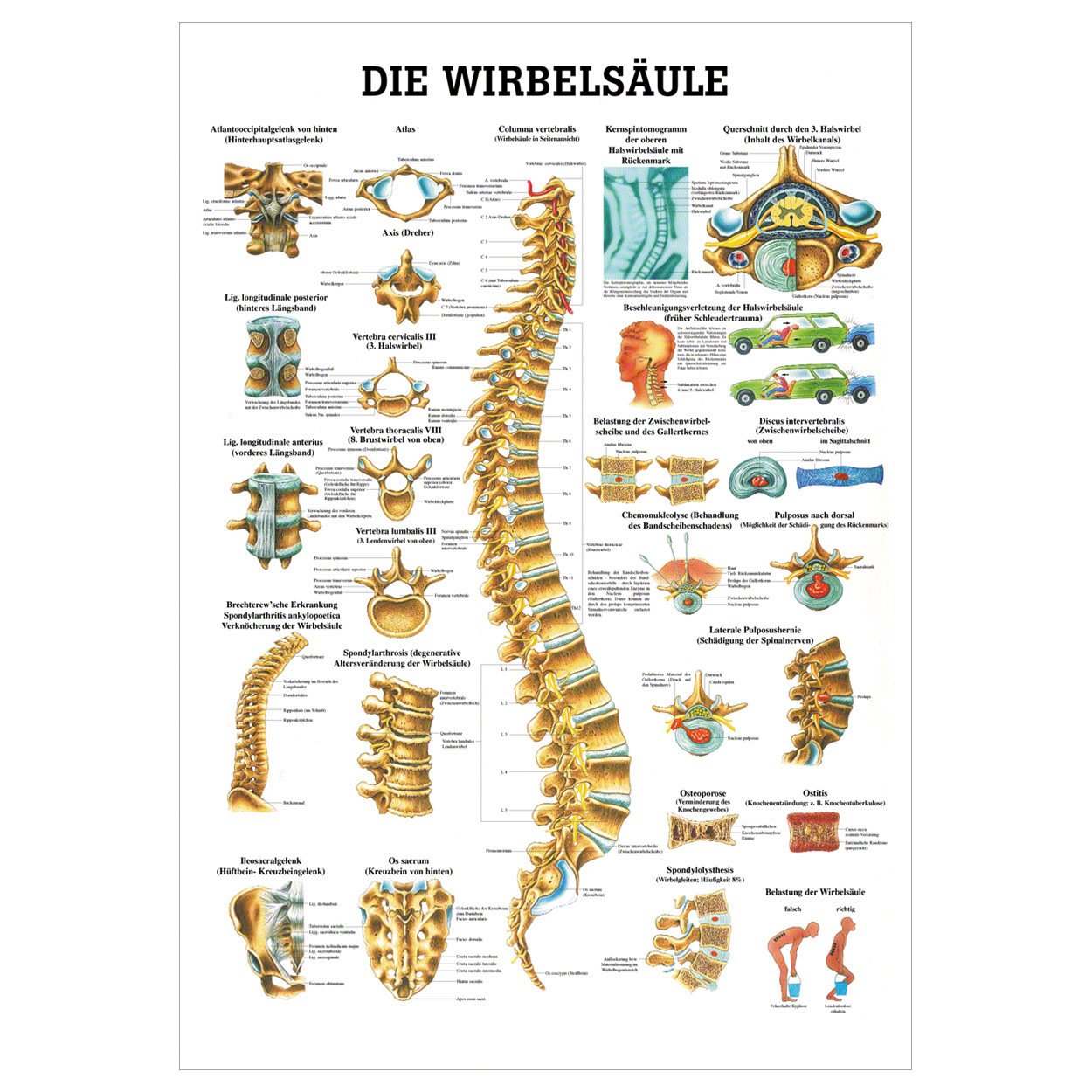 Anatomische Lehrtafel - Die Wirbelsäule