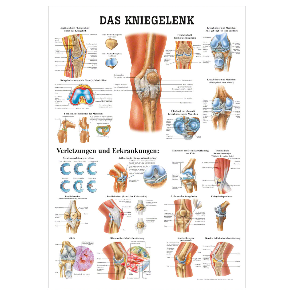 Anatomische Lehrtafel  -  Das Kniegelenk