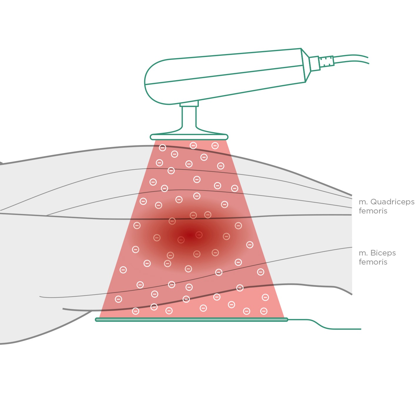Radiofrequenztherapie BTL 6000 TR-Pro