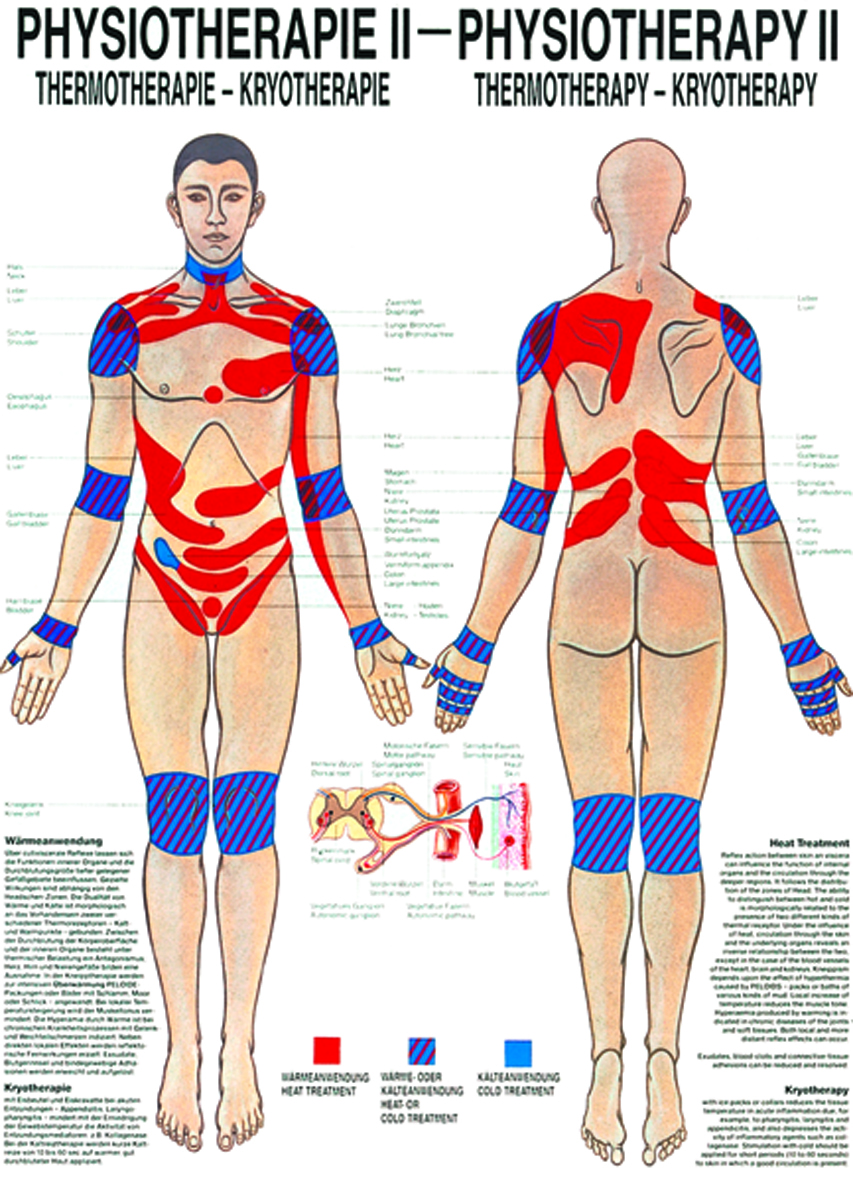 Anatomische Lehrtafel - Physiotherapie II, Thermotherapie